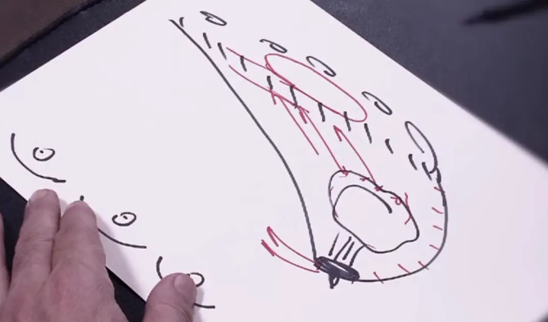 Un implante que 'aprende': la nueva era para la audición en Toledo